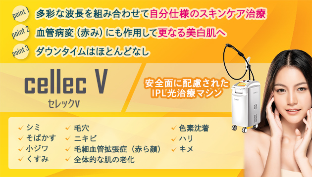 CellecV（セレックV）